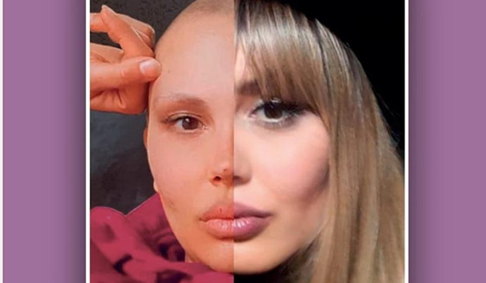 Foto Društvo onkoloških pacijenata